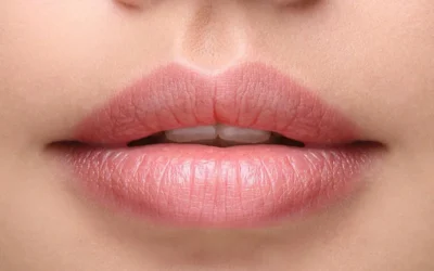 Explorando el Futuro: Perfilado de Labios con Ácido Hialurónico