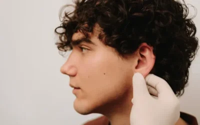 Rinomodelación en Valencia: Innovación no quirúrgica en el futuro de la estética nasal